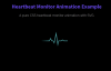 CSS Heartbeat Monitor Animation with SVG